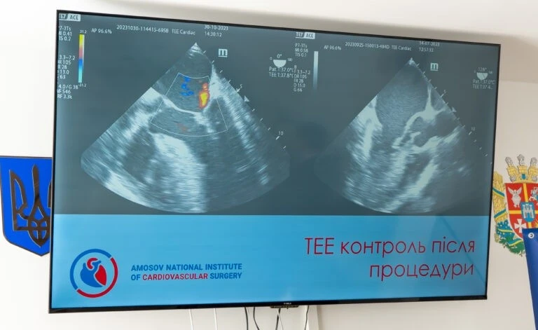 Кардіохірурги провели у Житомирі надскладну операцію за методом Амосова